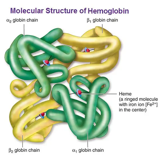 Unstable Hemoglobin Disease: Overview, Causes & Treatment